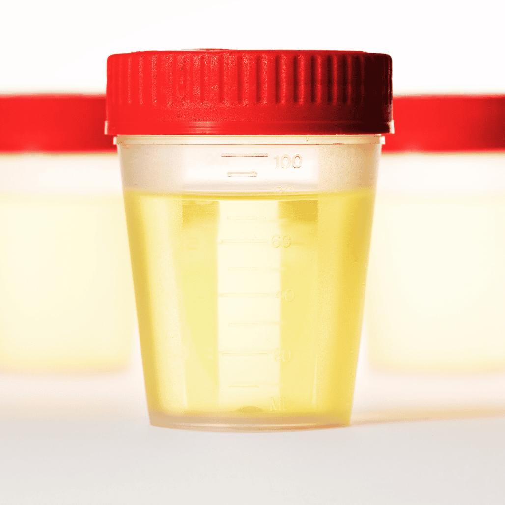 Cow urine sample bottle with red lid